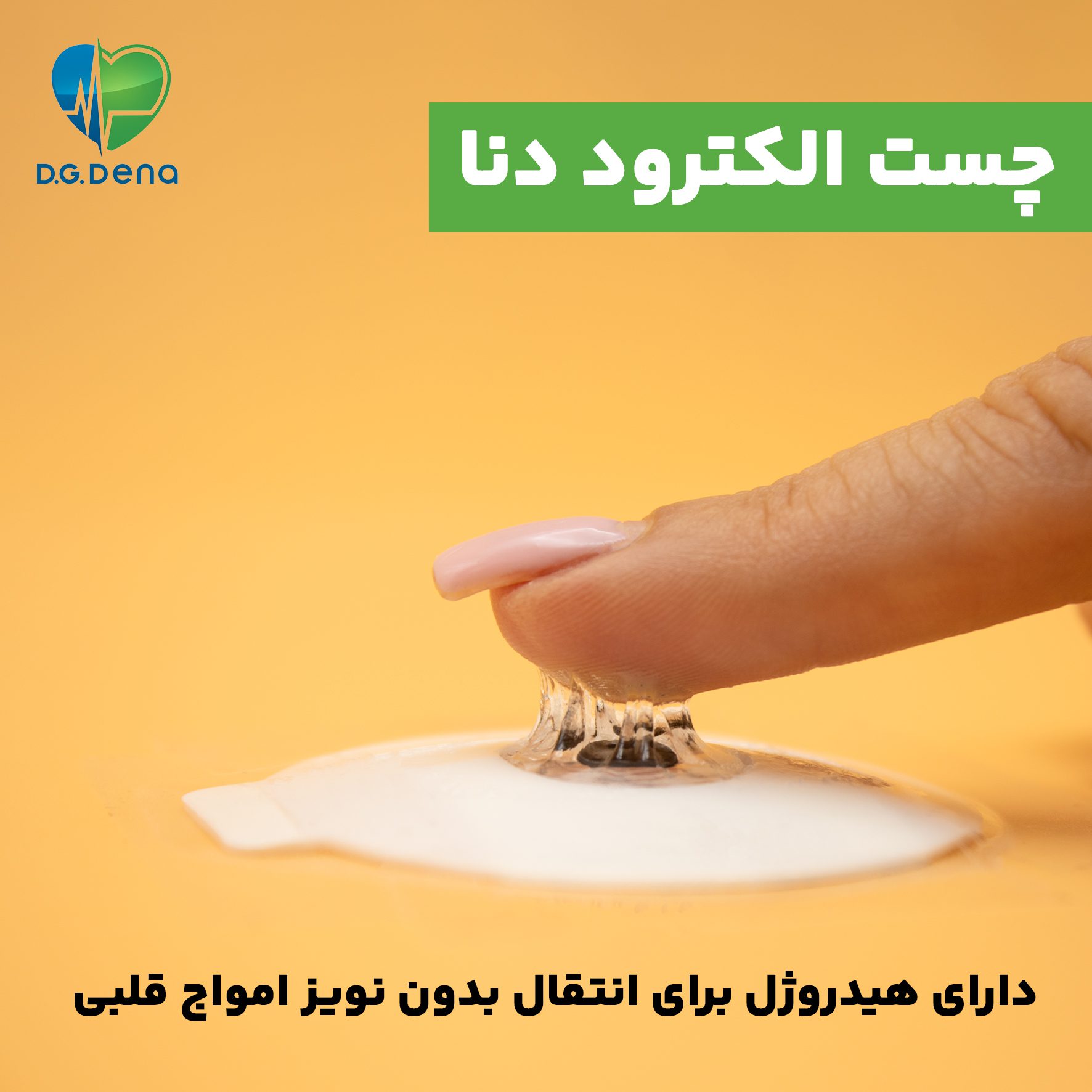 چسبندگی چست الکترود