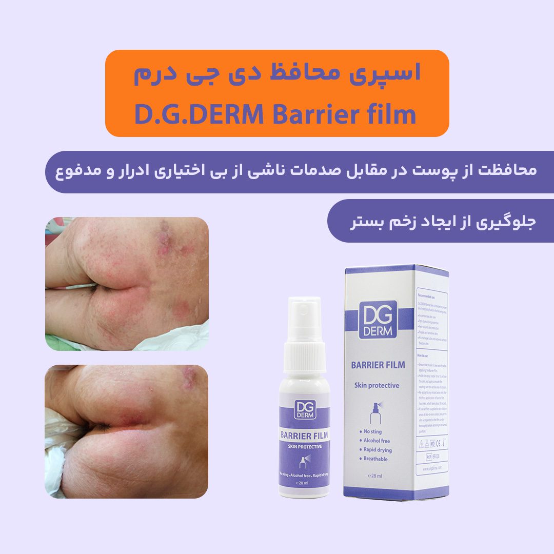 فیلم بریر