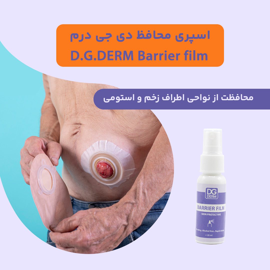 اسپری محافظ زخم باز
