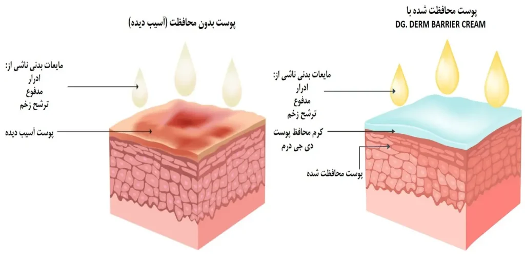 بریر کرم دی جی درم