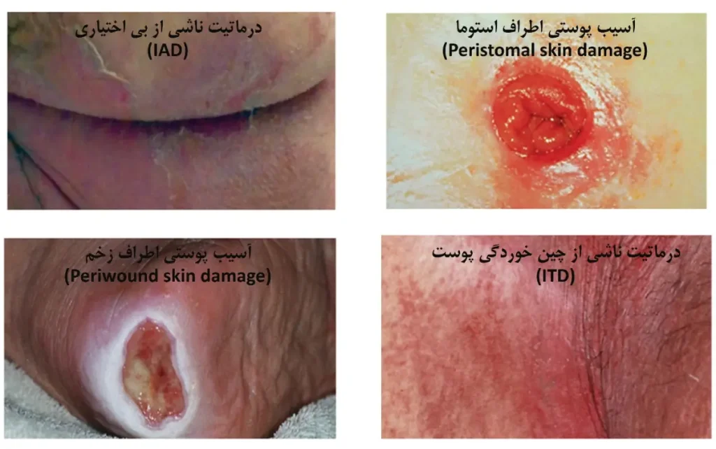 بریر کرم دی جی درم