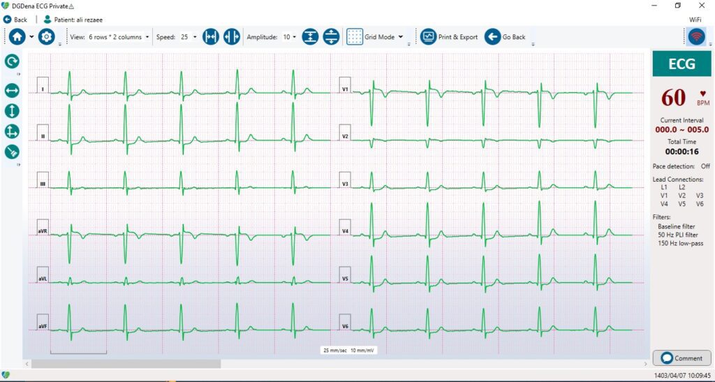 Electrocardiogram 